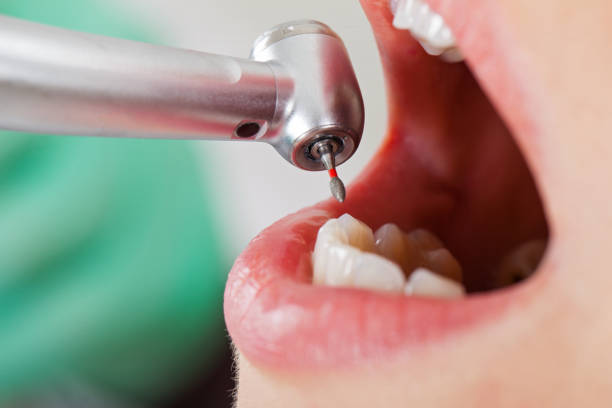 Best Emergency Dental Care for Broken or Chipped Teeth in Keaau, HI